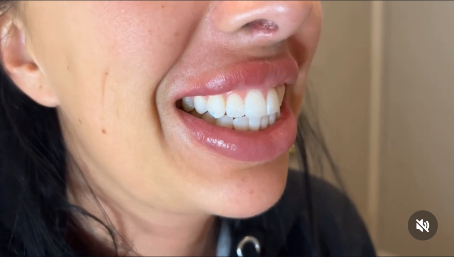 Brightened smile result — client cam