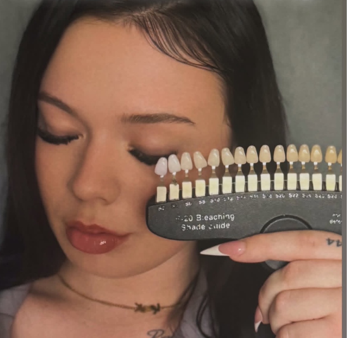 Bleaching Shade Guide